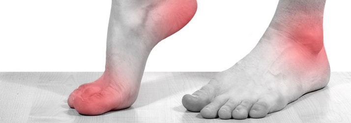 foot pain in Mobile AL