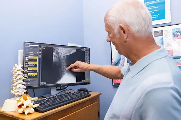 Chiropractor Mobile AL Donald Ellis Pointing To X-Ray Chiropractor Mobile AL Donald Ellis Pointing To X-Ray